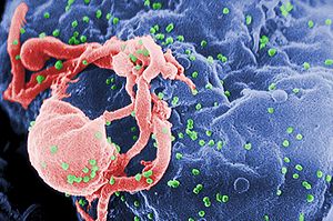 El VIH causa enfermedad cardíaca estructural