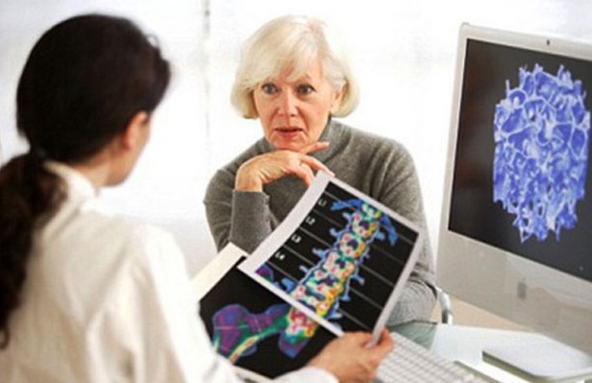 Expertos analizan el alto impacto sociosanitario y económico que ocasiona la osteoporosis femenina