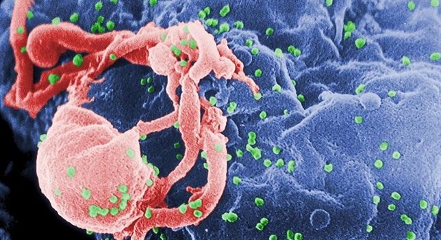 Detectan presencia de VIH en la niña estadounidense que se creía curada