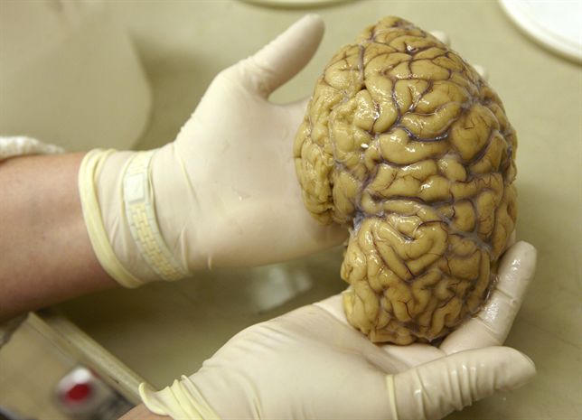 Investigan un nuevo tratamiento contra la parálisis cerebral