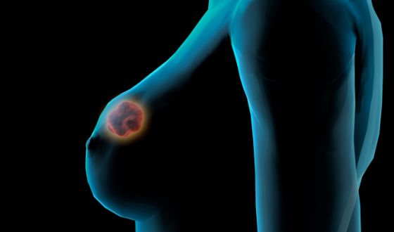 Crean un nuevo dispositivo para paliar el dolor en las mamografías