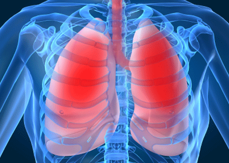 Un análisis de sangre podría sustituir las biopsias en cáncer de pulmón