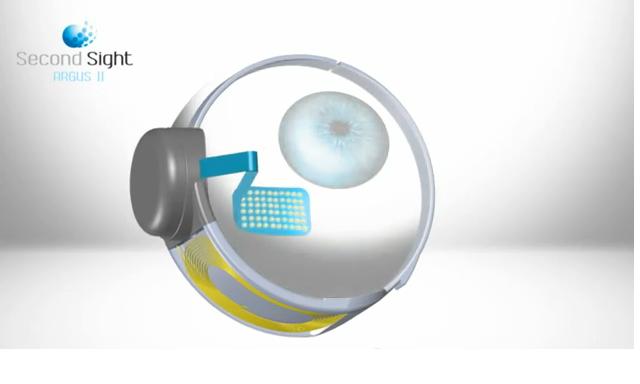 Un ojo biónico permite a un hombre ciego distinguir formas humanas y ver su propio reflejo en una ventana
