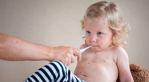 EE.UU. sopesa resucitar la vacuna contra el sarampión tras el brote en California