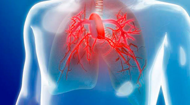 La Dra. Delgado y la metástasis pulmonar