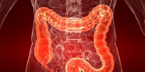 El 65% de los pacientes con enfermedad de Crohn tratados con GED-0301, de Celgene, alcanzó la remisión clínica, según un estudio publicado en el NEJM