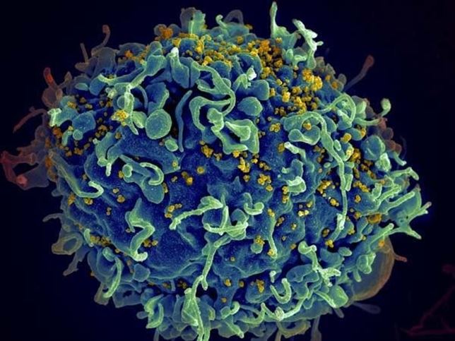El VIH se replica en el cerebro a los cuatro meses de la infección