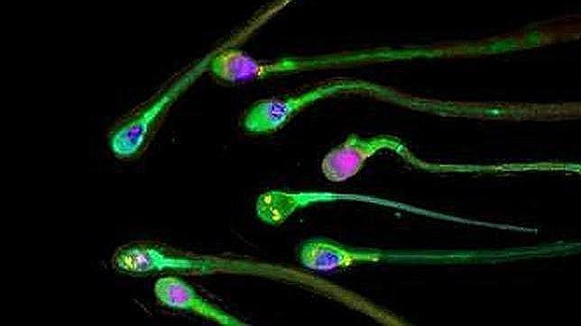 Los espermatozoides más rápidos son los más dotados para la fertilización