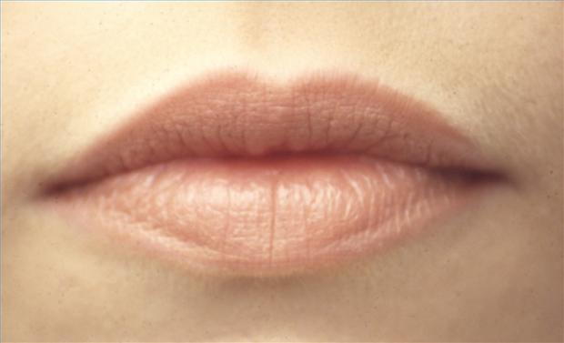 ¿Cómo se previene un cáncer de labios?