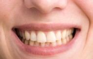 El diez por ciento de las visitas al dentista son a causa del bruxismo