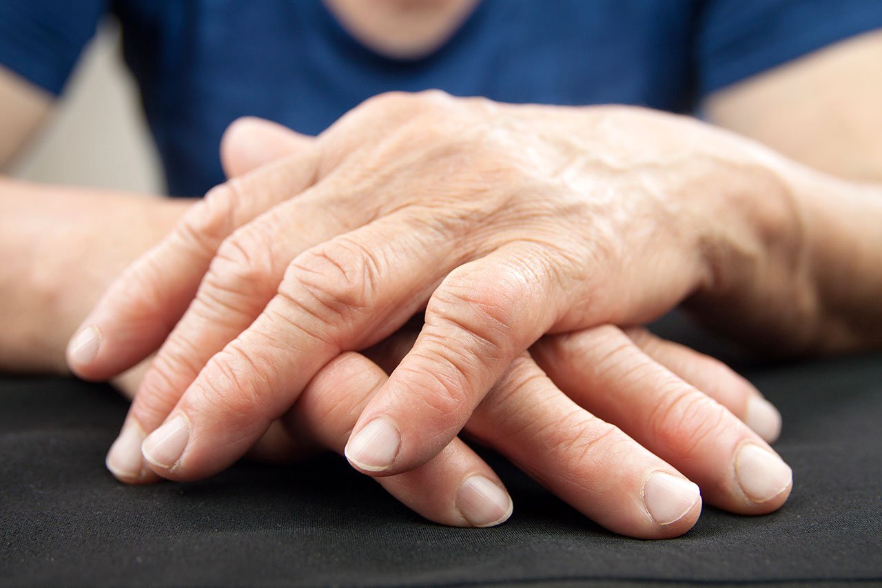 Los mejores ejercicios contra la artritis reumatoide