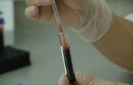 La prueba del VIH, en farmacias y sin prescripción médica