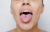 Piercings en la lengua y en los labios pueden suponer complicaciones para la salud bucodental
