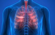 Semana Internacional de la Fibrosis Pulmonar Idiopática