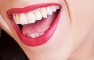 La estética dental, una nueva tendencia