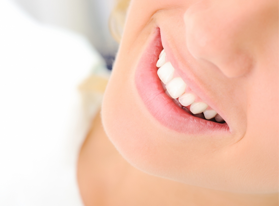 El blanqueamiento dental debe realizarse bajo la supervisión de un dentista