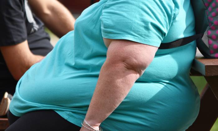 El sedentarismo y el consumo de productos industriales y ultraprocesados, causas del crecimiento de la obesidad