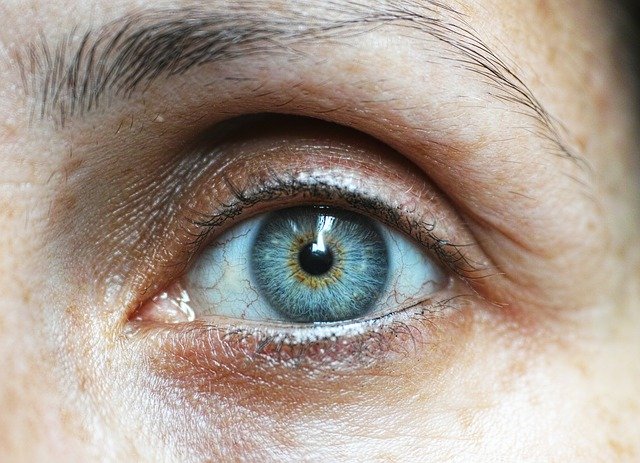 Luz pulsada IPL para el tratamiento del síndrome del ojo seco