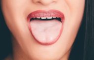 ¿Cómo eliminar llagas en la lengua fácilmente?