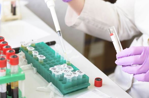 Test genético en orina para predecir el cáncer de vejiga