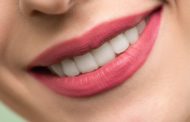 El blanqueamiento dental, tratamiento conservador e indoloro para mejorar la sonrisa