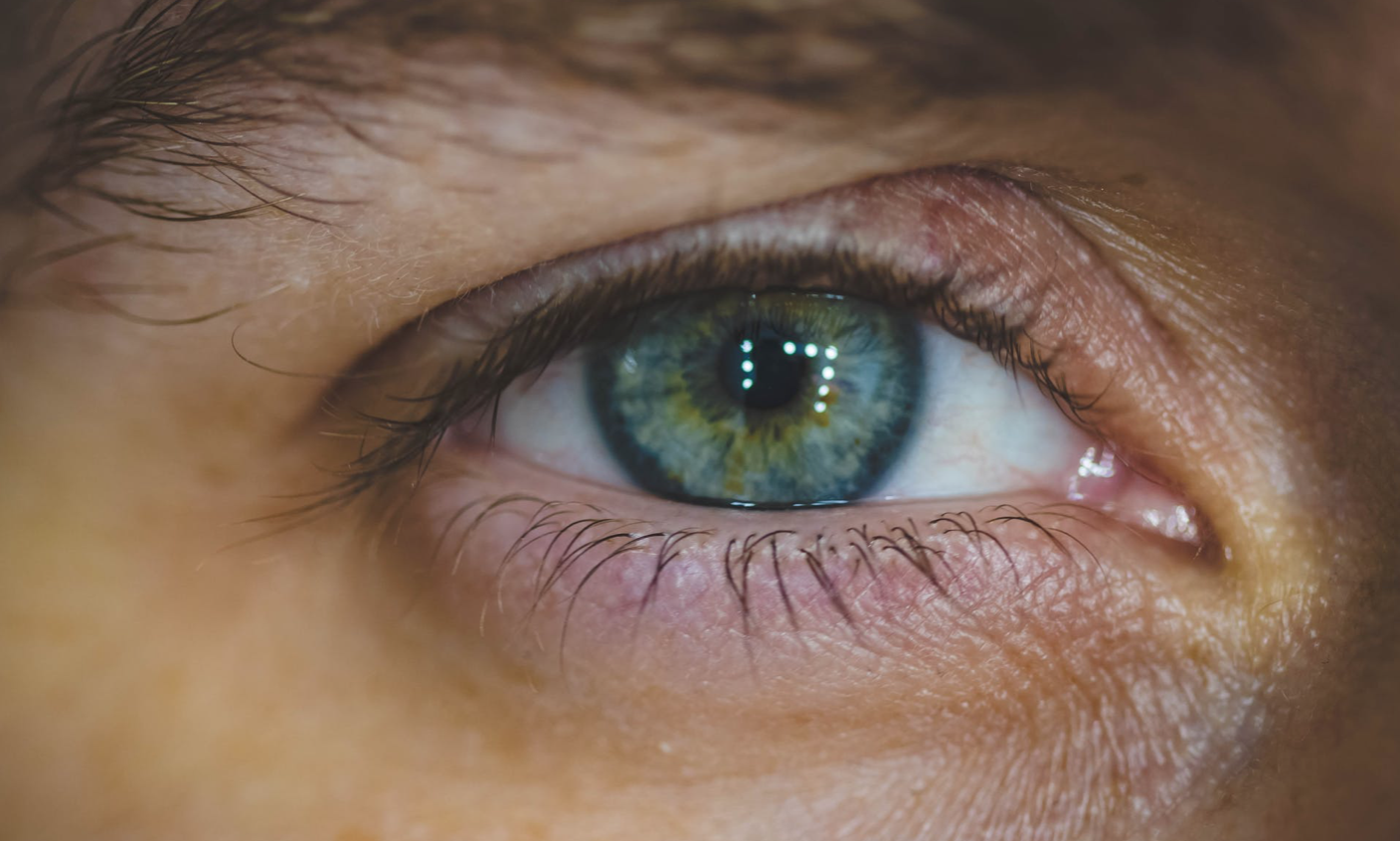 ¿Qué es la uveítis y la retinosis pigmentaria?