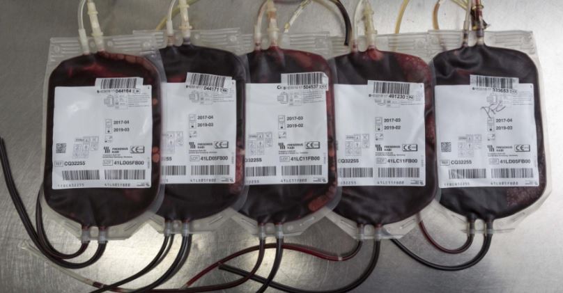 El Centro de Transfusión hace un llamamiento a la población para que acuda a donar