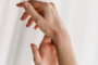 Dishidrosis: ¿Cómo tratarla?